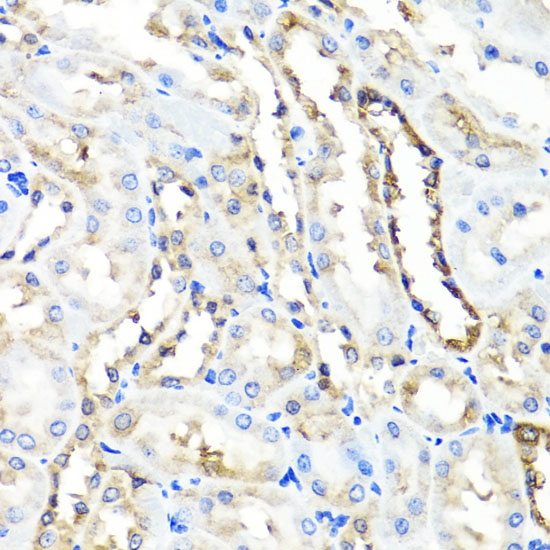 HYAL1 Rabbit polyclonal antibody