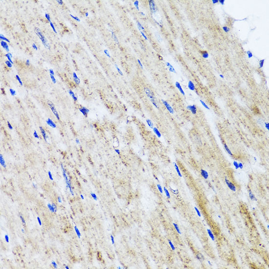 HYAL1 Rabbit polyclonal antibody