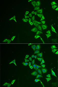 INPP5J Rabbit polyclonal antibody