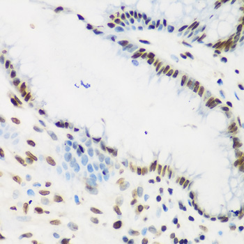KLF4 Rabbit polyclonal antibody