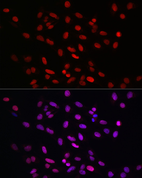 KLF4 Rabbit polyclonal antibody