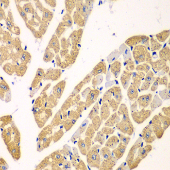 KYNU Rabbit polyclonal antibody
