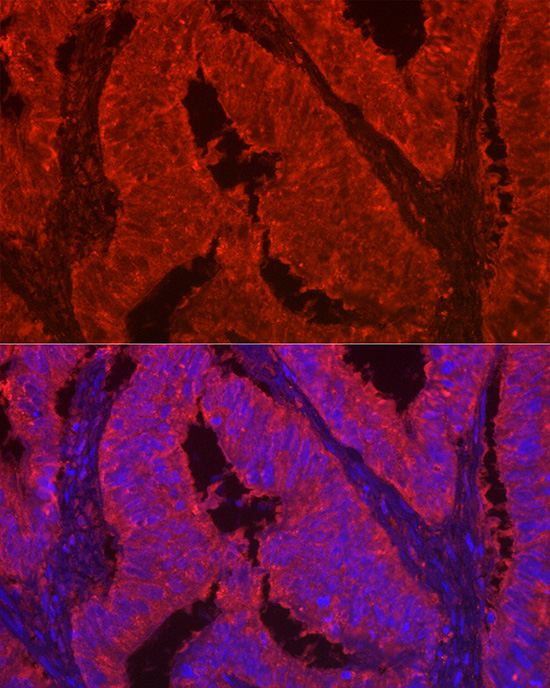 LGALS2 Rabbit polyclonal antibody