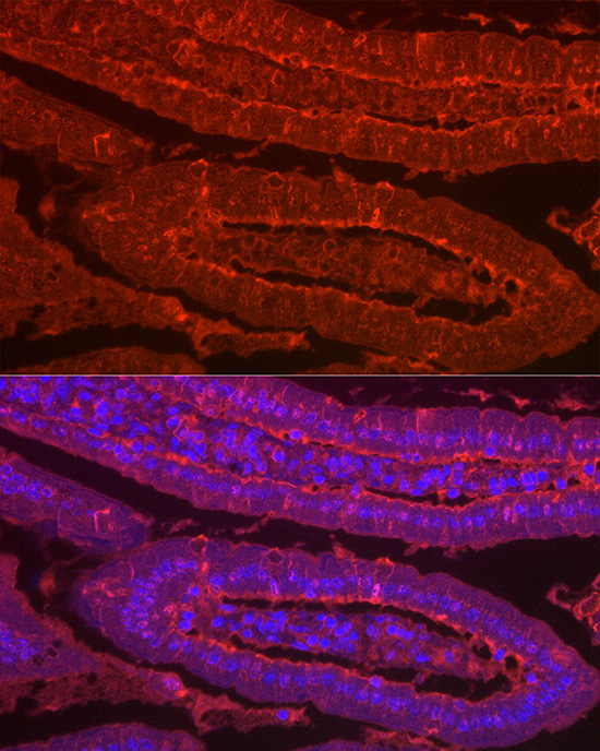 LGALS2 Rabbit polyclonal antibody