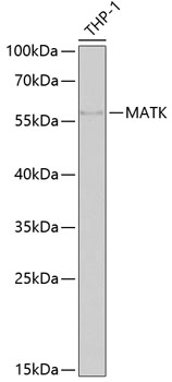 MATK Rabbit polyclonal antibody
