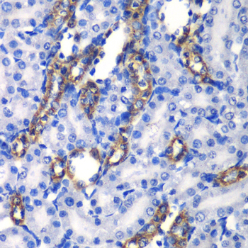 MATK Rabbit polyclonal antibody