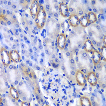 MATK Rabbit polyclonal antibody