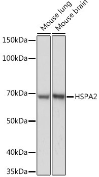 HSPA2 Rabbit monoclonal antibody