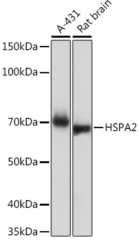HSPA2 Rabbit monoclonal antibody