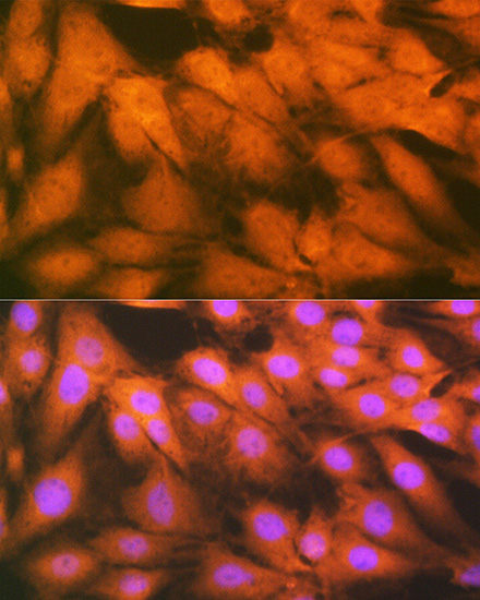 HSPA2 Rabbit monoclonal antibody