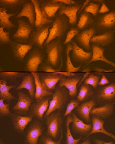 HSPA2 Rabbit monoclonal antibody