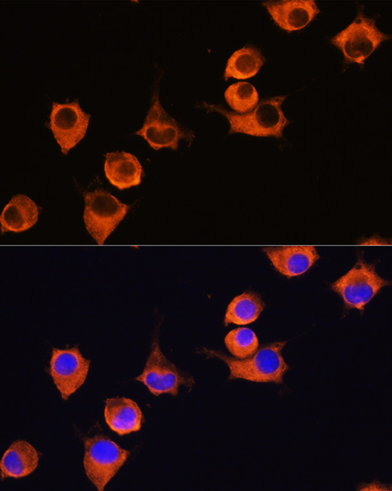MFI2 Rabbit polyclonal antibody