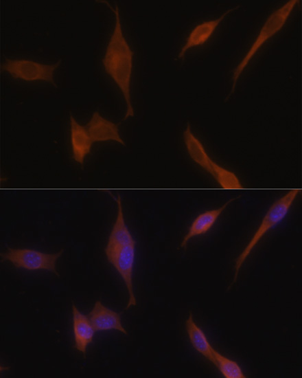 MLPH Rabbit polyclonal antibody