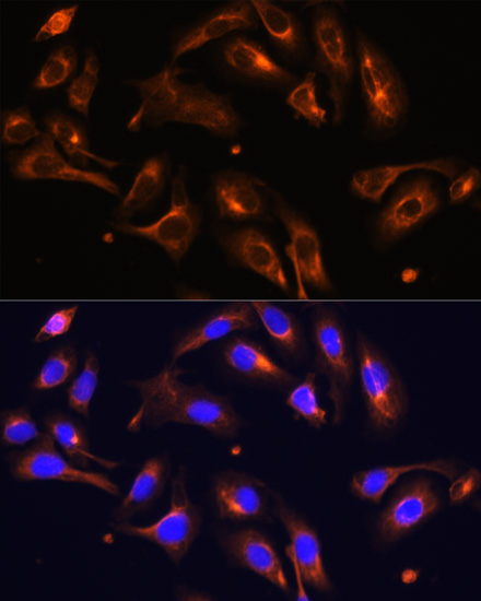 MLPH Rabbit polyclonal antibody