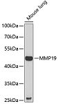 Western blot - MMP19 Rabbit pAb (A6657)