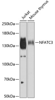 NFATC3 Rabbit polyclonal antibody