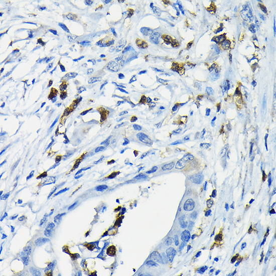 NFATC3 Rabbit polyclonal antibody