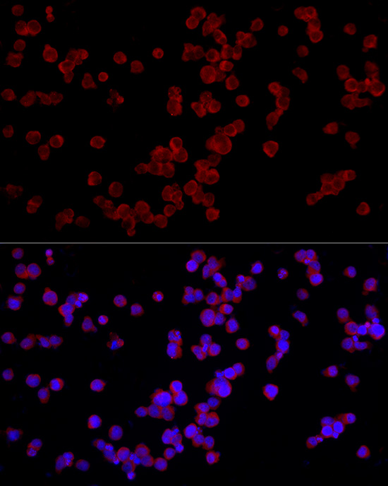NFATC3 Rabbit polyclonal antibody