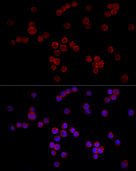 NFATC3 Rabbit polyclonal antibody