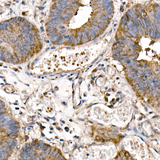 NFKB1 Rabbit polyclonal antibody