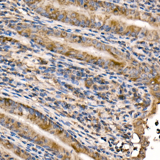 NFKB1 Rabbit polyclonal antibody