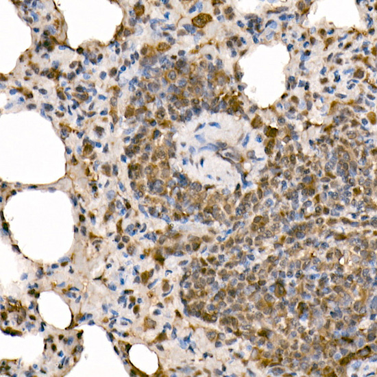 NFKB1 Rabbit polyclonal antibody