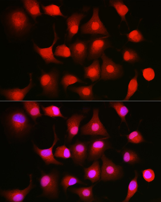 NFKB1 Rabbit polyclonal antibody