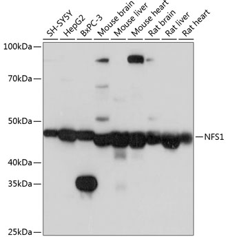 NFS1 Rabbit polyclonal antibody