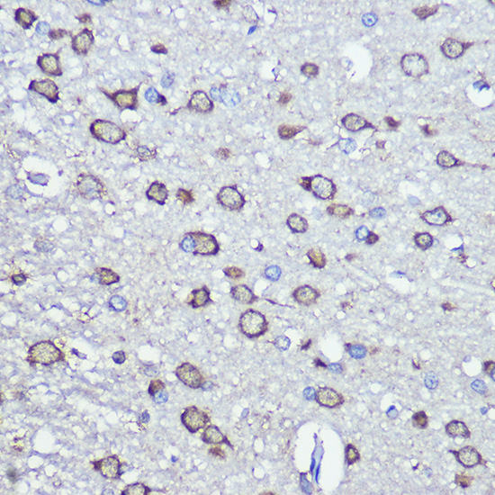 NFS1 Rabbit polyclonal antibody