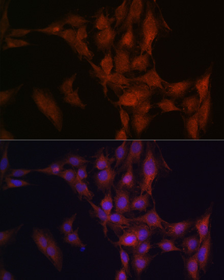 NFS1 Rabbit polyclonal antibody