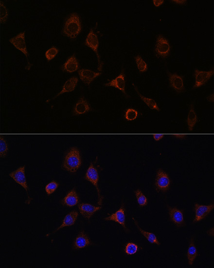 NFS1 Rabbit polyclonal antibody