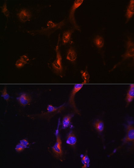 NFS1 Rabbit polyclonal antibody