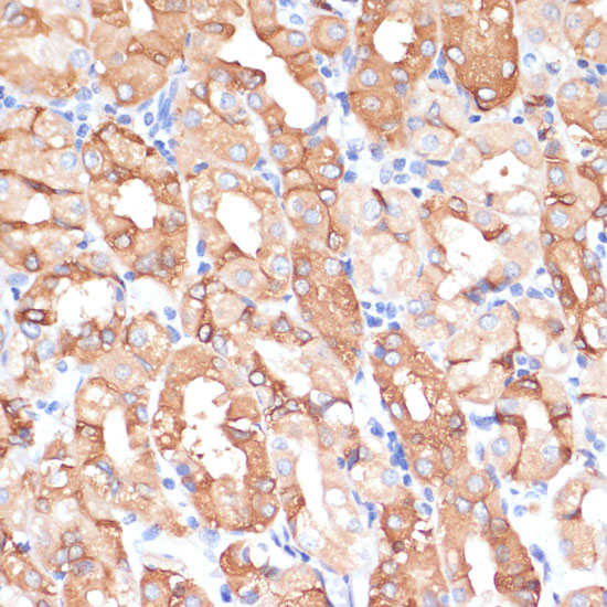NHLRC1 Rabbit polyclonal antibody