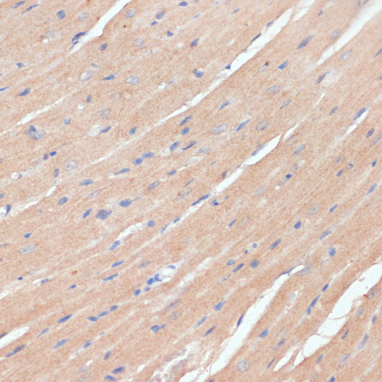NHLRC1 Rabbit polyclonal antibody