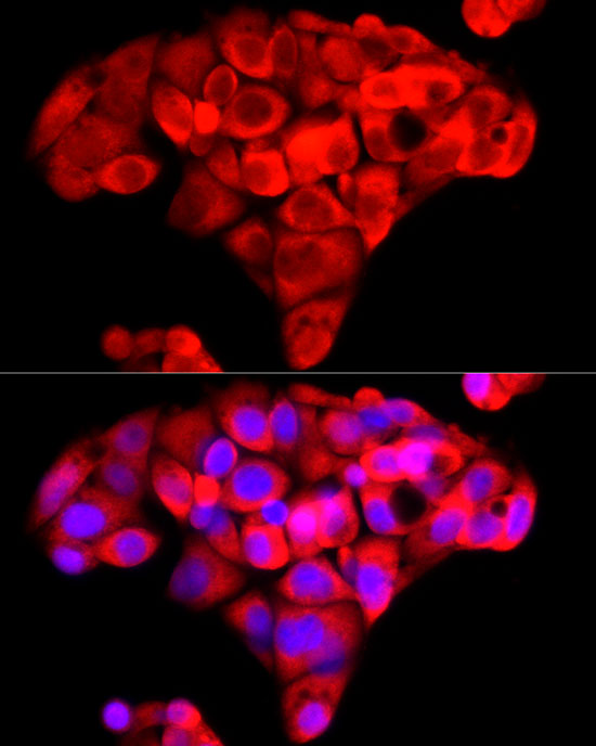 NNMT Rabbit polyclonal antibody