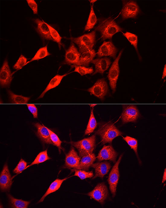 NNMT Rabbit polyclonal antibody