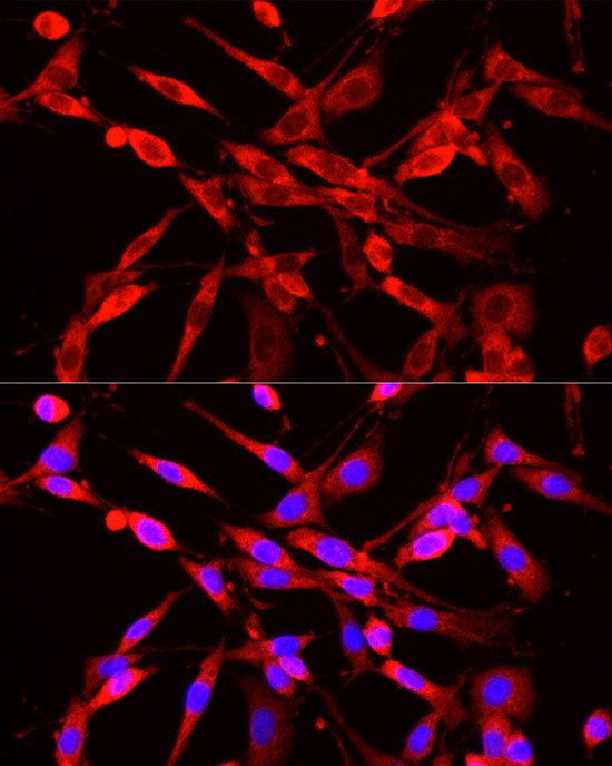 NNMT Rabbit polyclonal antibody