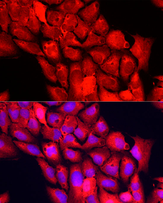 NNMT Rabbit polyclonal antibody
