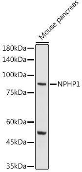 NPHP1 Rabbit polyclonal antibody