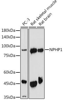 NPHP1 Rabbit polyclonal antibody
