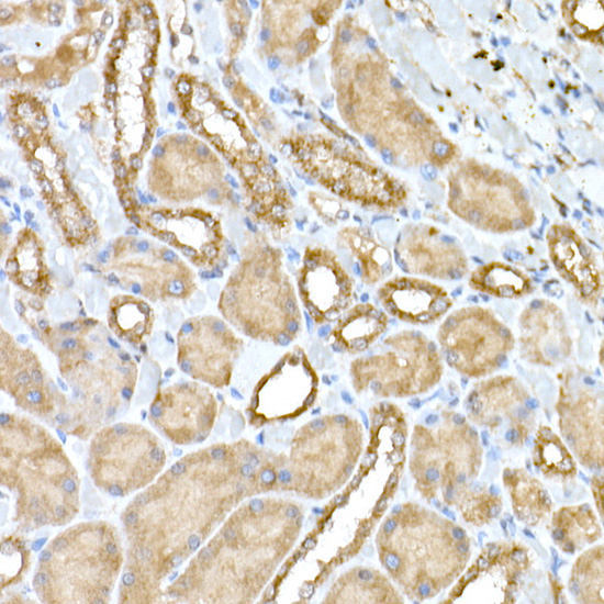 NPHP1 Rabbit polyclonal antibody