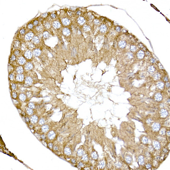NPHP1 Rabbit polyclonal antibody