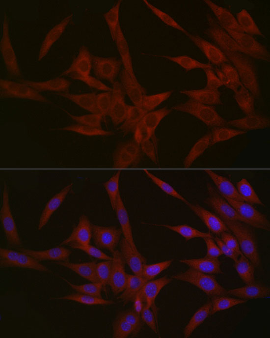 NPHP1 Rabbit polyclonal antibody
