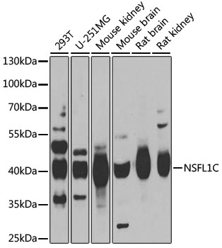 NSFL1C Rabbit polyclonal antibody
