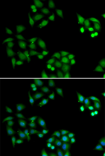 NSFL1C Rabbit polyclonal antibody