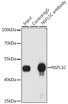 NSFL1C Rabbit polyclonal antibody