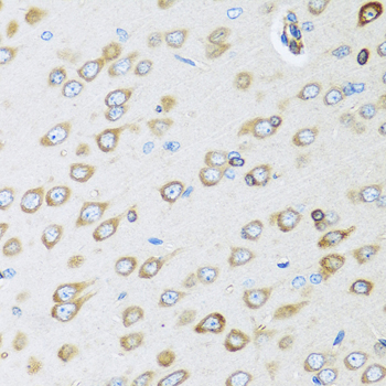 Osteoglycin (OGN) Rabbit polyclonal antibody