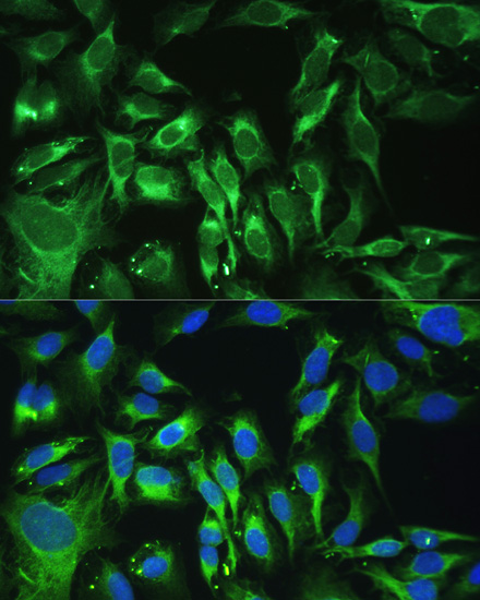Osteoglycin (OGN) Rabbit polyclonal antibody