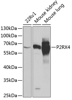 P2RX4 Rabbit polyclonal antibody