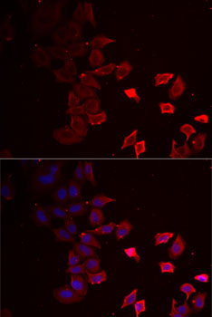 P2RX4 Rabbit polyclonal antibody
